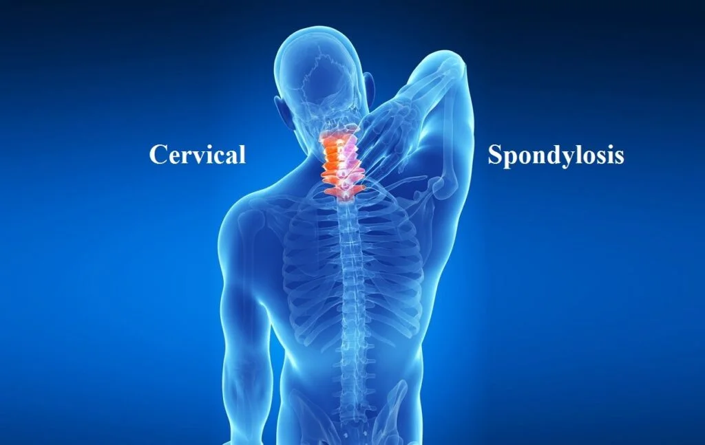 Neck Pain
