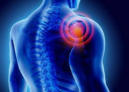 Frozen Shoulder Treatment