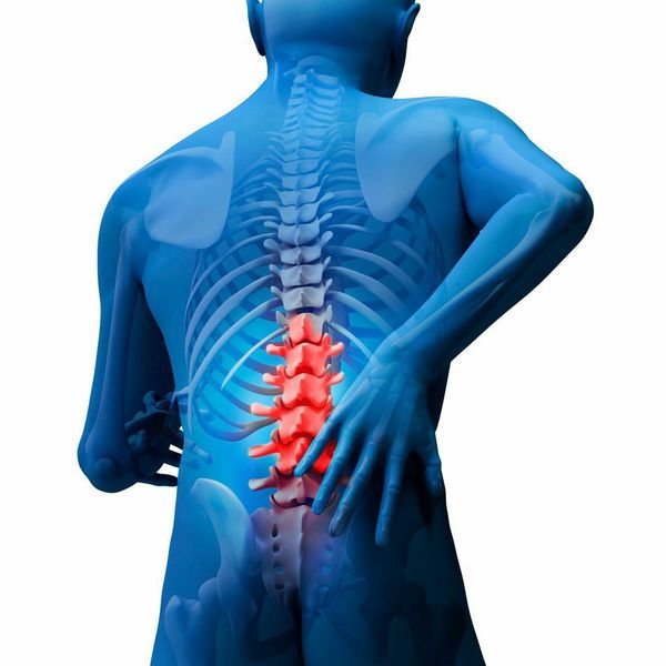 Slipped Disc Treatment