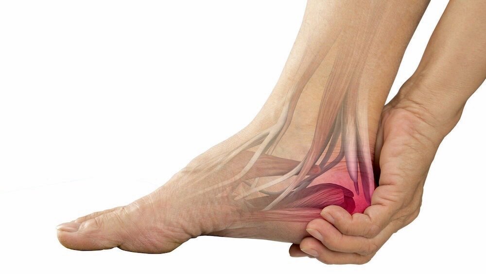 Tendonitis
