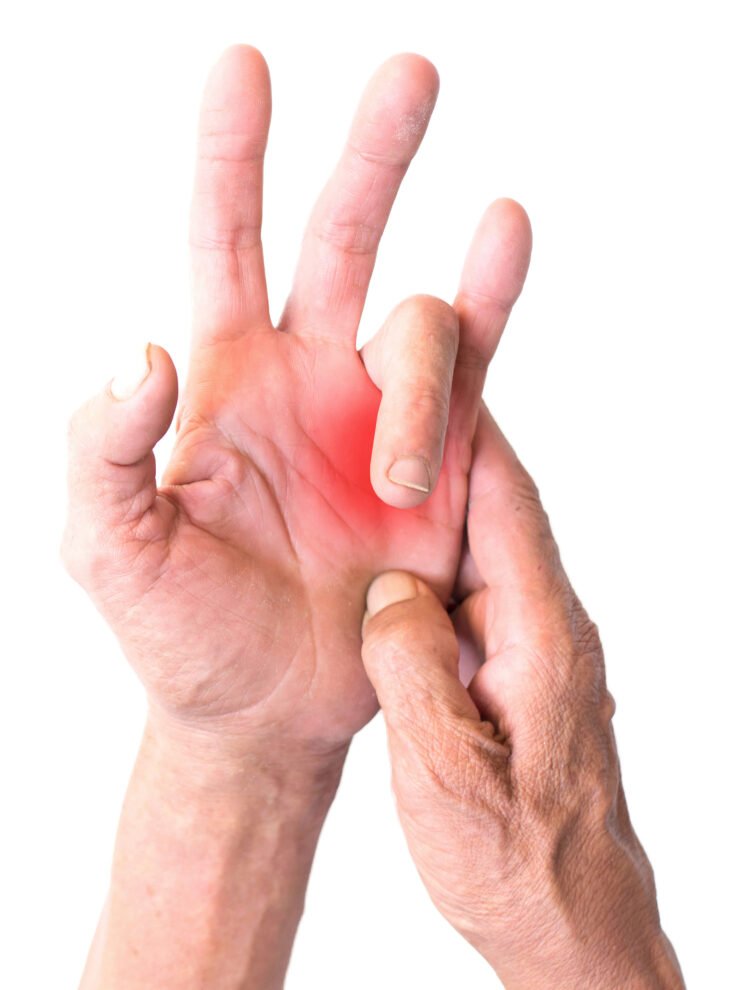 Trigger Finger Treatment